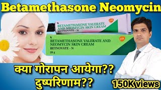 Betnovate N cream  Betamethasone Neomycin cream  betnovate n skin cream [upl. by Anilocin]