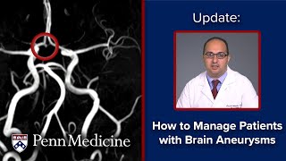 Hautants test Vertebral artery test [upl. by Berner]