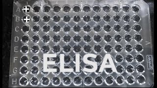 ELISA  How to do ELISA  step by step procedure for ELISA [upl. by Bourn358]