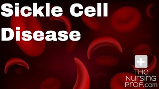 Sickle Cell Disease and Sickle Cell Crisis [upl. by Nirol328]