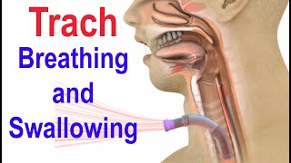 Trach Breathing and Swallowing [upl. by Enaujed]