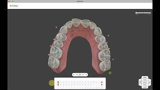 ArchForm Aligner Design Software [upl. by Sirtimed]