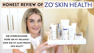 ZO Skincare Review Hydroquinone for Melasma did it work [upl. by Malone644]