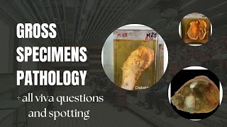 Gross specimens pathology Important viva questions of pathology Pathology practicals [upl. by Sire]