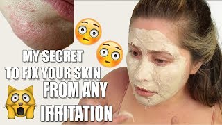 GET RID OF SKIN RASHES ON FACE  Allergic reaction [upl. by Nyrmak333]