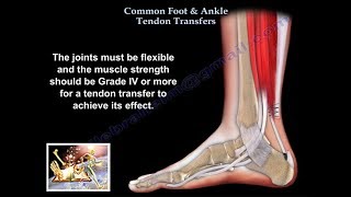 Common Foot amp Ankle Tendon Transfers  Everything You Need To Know  Dr Nabil Ebraheim [upl. by Takara]