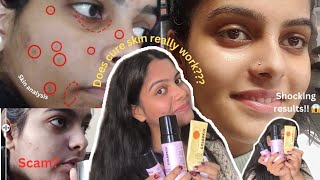 Brutally Honest CureSkin Review My Shocking Experience 😱😨 [upl. by Cordalia696]