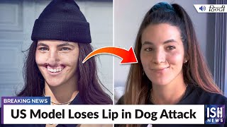 US Model Loses Lip in Dog Attack  ISH News [upl. by Boles]