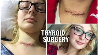 MY THYROID REMOVAL SURGERY  UPDATE [upl. by Notffilc415]