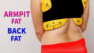 5 Simple Exercise to burn Back amp Armpit Fat [upl. by Bonacci]