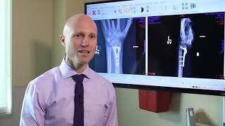 Broken Wrists Fracture Types Treatment Options amp Recovery  Dr Froelich [upl. by Lawson]