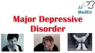 Major Depressive Disorder  DSM5 Diagnosis Symptoms and Treatment [upl. by Neumark]