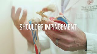 Shoulder Impingement Causes and Treatment [upl. by Rakso72]