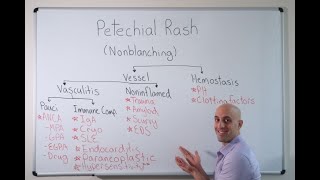 Petechial Rash  Approach [upl. by Winwaloe]