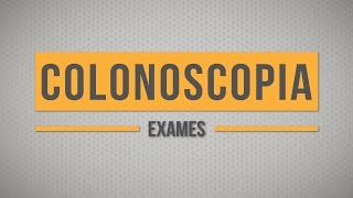 Colonoscopia  Exames [upl. by Gargan151]