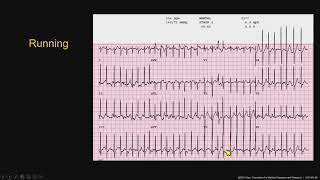 Technology SeriesMedicalStress Testing Pearls [upl. by Aneres803]