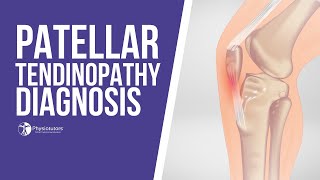 How to Diagnose Patellar Tendinopathy  Jumpers Knee Diagnosis [upl. by Noired]