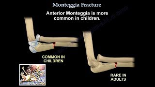 Radial Nerve Anatomy  Everything You Need To Know  Dr Nabil Ebraheim [upl. by Hairahcaz]