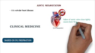 SIGNS OF AORTIC REGURGITATION  PG NOTES [upl. by Enneire]