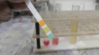 Urine Albumin Test [upl. by Aydin590]