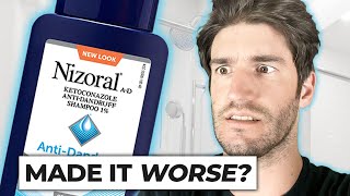 Nizoral Shampoo For Hair Loss  THE TRUTH [upl. by Anoek544]