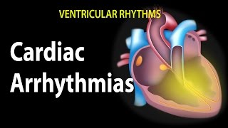 Cardiac Arrhythmias Animation [upl. by Wendalyn]