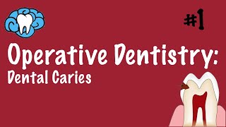 Operative Dentistry  Dental Caries  INBDE ADAT [upl. by Ponzo]