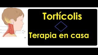 Tortícolis congénita tensión en cuello  Terapia en casa [upl. by Sewel]