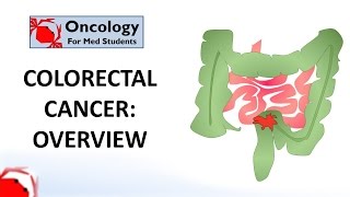 Colorectal Cancer An overview [upl. by Esiouqrut]