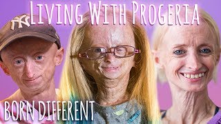 Adalia Rose holds fundraiser for Progeria [upl. by Lurette]