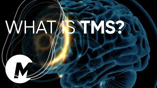 What is TMS How does TMS work MagVenture TMS Therapy [upl. by Den]