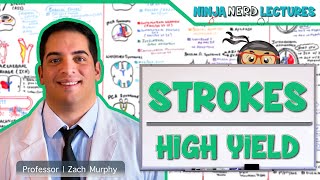 Ischemic and Hemorrhagic Strokes  High Yield [upl. by Zenia]