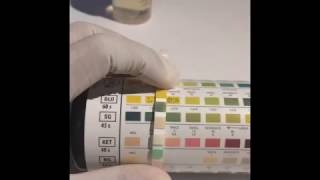 UTI dipstick test Urine Analysis [upl. by Sedaiuqlem]