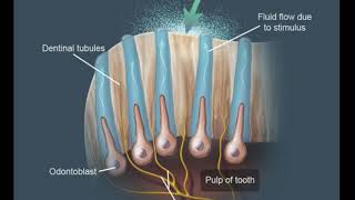 Dentin Hypersensitivity Theories Lecture [upl. by Erich]