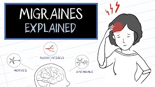 Migraine Pathophysiology  In depth [upl. by Eramat900]