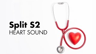 Fixed Split S2  Heart Sounds  MEDZCOOL [upl. by Aletta497]