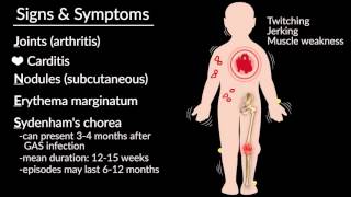 Acute Rheumatic Fever by E Rusingiza  OPENPediatrics [upl. by Brynne]