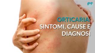 Orticaria sintomi cause e diagnosi [upl. by Adnoel]