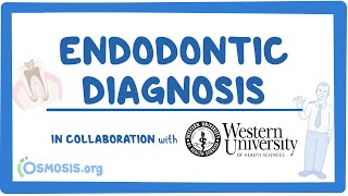 Endodontic Diagnosis in Collaboration w Western University [upl. by Merriam422]