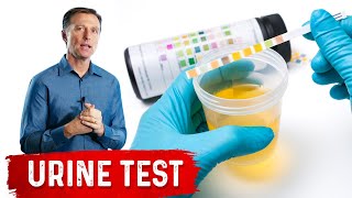 Urine Test Simplified [upl. by Htebharas]