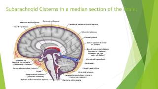 Subarachnoid Cisterns – Anatomy [upl. by Rainwater]