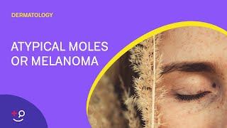 Dog Oral Malignant Melanoma VLOG 116 [upl. by Ajad637]