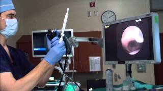 Flexible Bronchoscopy Introduction 5  Insertion [upl. by Oicelem]