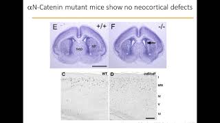 Using human stem cells to model neocortical gyration phenotypes [upl. by Alahc369]