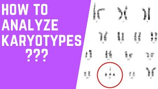 How to Analyze Karyotypes 101 [upl. by Ellehcyar101]