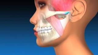 TMJ Explanation amp Therapy [upl. by Lekkim]