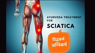 Viddhakarm  Episode 14  Sciatica Viddhakarma [upl. by Elorac772]