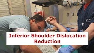 Inferior Shoulder Dislocation Reduction [upl. by Bick]