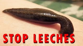 How to stop Leeches [upl. by Gnuj]