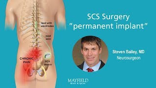 EVD Lumbar Drain System Setup and Overview Medtronic [upl. by Leith]